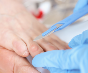 Clinical Skin, Hair, Nail Diseases